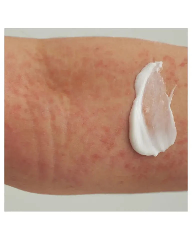 Extroderm Körpercreme 200 ml